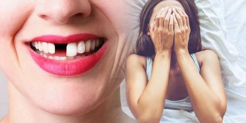 Nằm Mơ Thấy Rụng Răng Đánh Số Gì - Mibet Giải Mã Giấc Mơ 2024 2 Nam-mo-thay-rung-rang-danh-so-gi-mo-rung-rang-tren