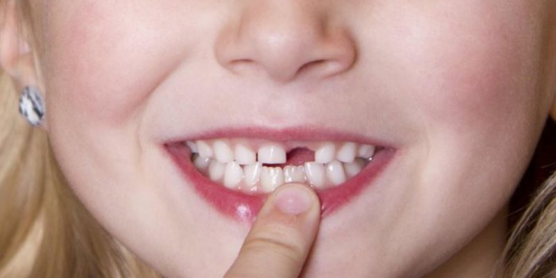 Nằm Mơ Thấy Rụng Răng Đánh Số Gì - Mibet Giải Mã Giấc Mơ 2024 4 Nam-mo-thay-rung-rang-danh-so-gi-rung-rang-khong-chay-mau